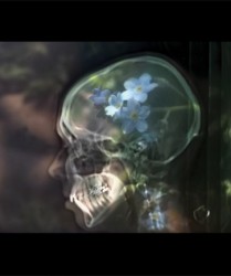 Photography on glass, oac base : x-ray photograph in front of forget-me-not flowers • 9x16cm • GALLERY PHOTOGRAPHY