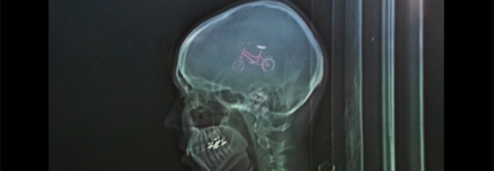 Photography on glass, oac base : x-ray photograph in front of a little bike • 9x16cm • GALLERY PHOTOGRAPHY