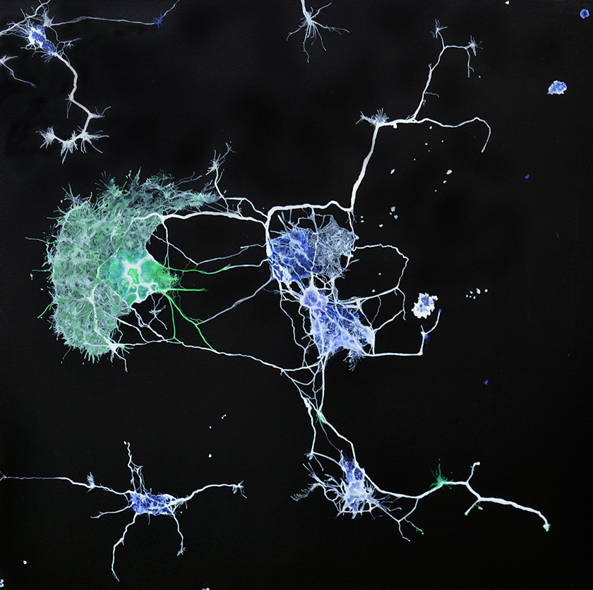 tilt – connecting neurons